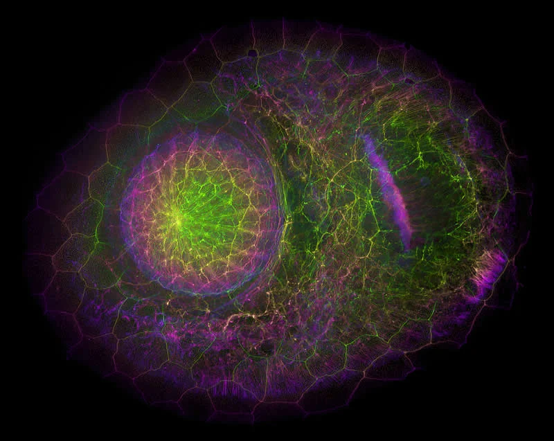 42 Award-Winning Photos From Nikon Small World Photomicrography Competition Reveal a Hidden Universe 85 Developing pupil and optic nerve tract of a Zebrafish embryo by Dr. James Hayes - Nikon Small World Photomicrography Competition Winners